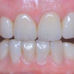 Reabilitare orală - DecoPraxis - Dr. Dragomir