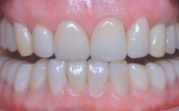 Reabilitare orală – DecoPraxis
